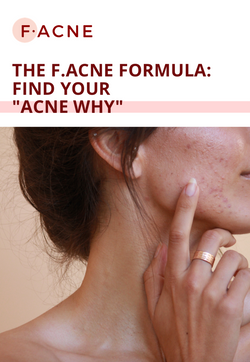 FREE eBOOK: The F.ACNE Formula - Unrefinedbynicola